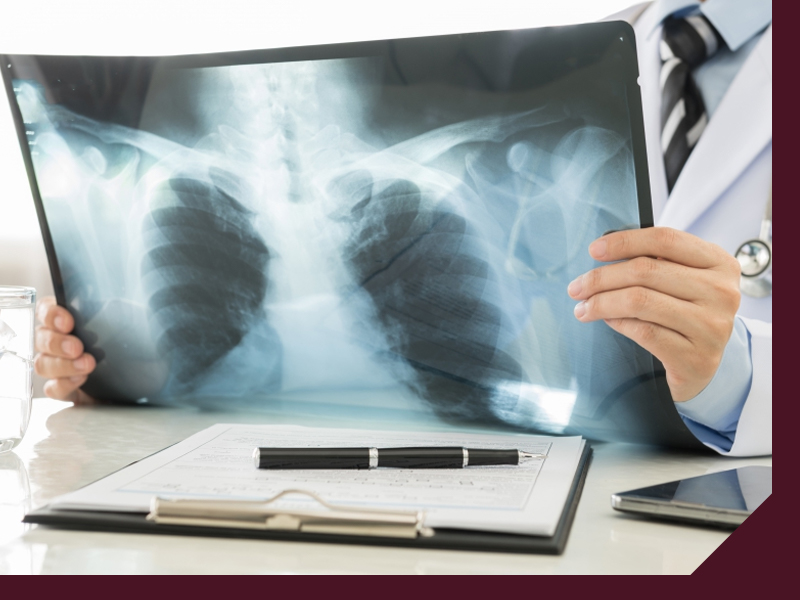 x-ray x-ray