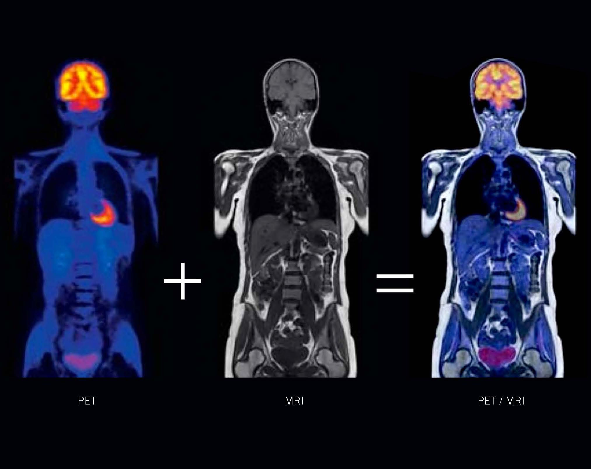 petmri_diag petmri_diag