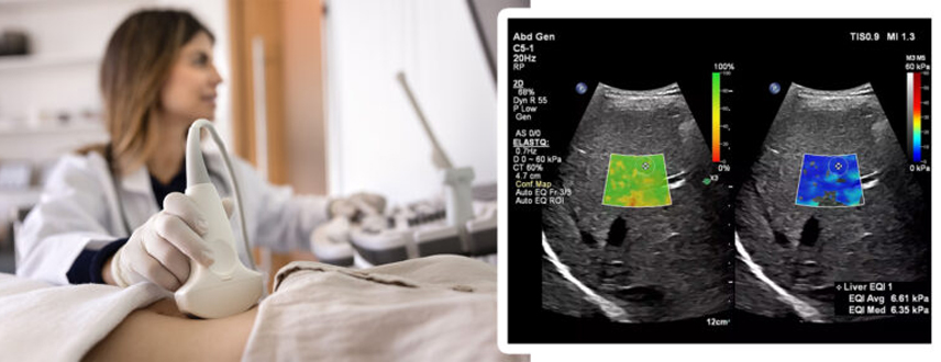 Echocardiography at Zwanger-Pesiri