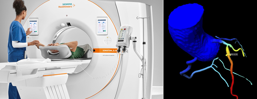 Fractional flow reserve CT exam