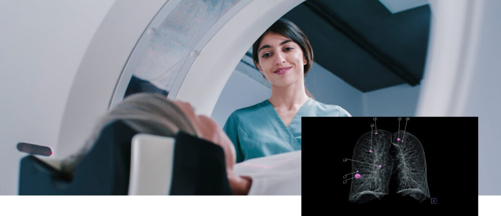 CT lung screening exam