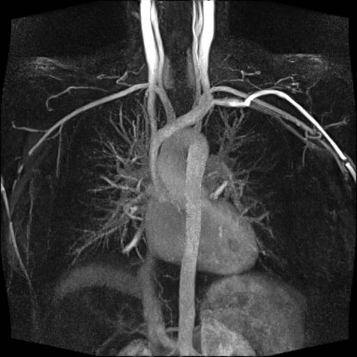 MR Angiography exam of the cardiovascular system