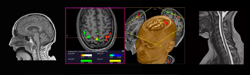 Neurological MRI