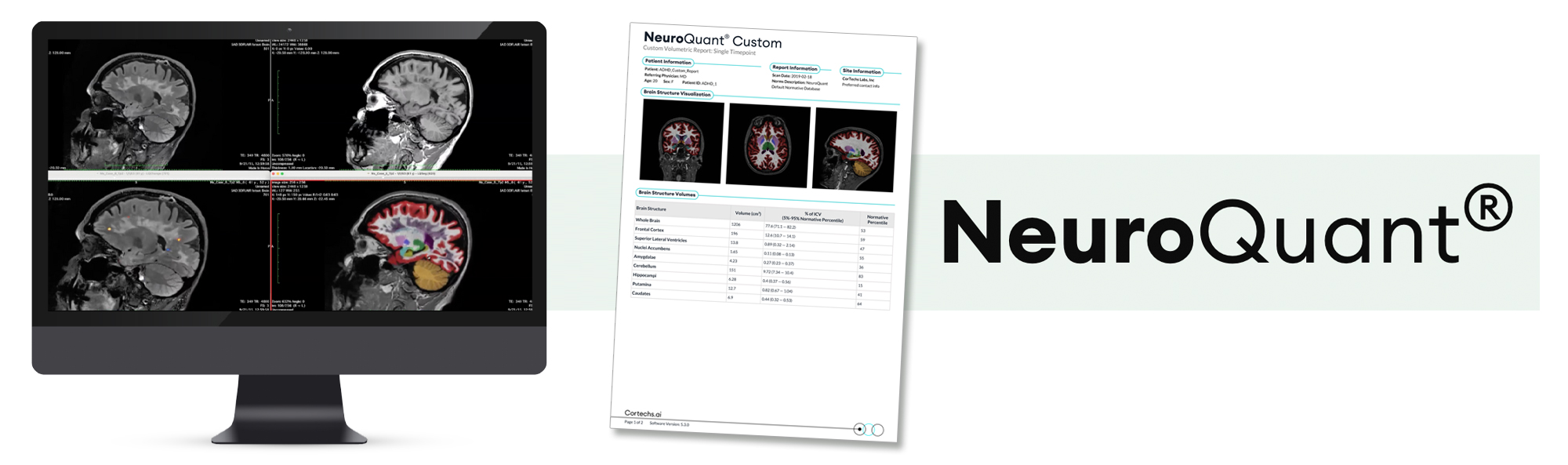 NeuroQuant AI
