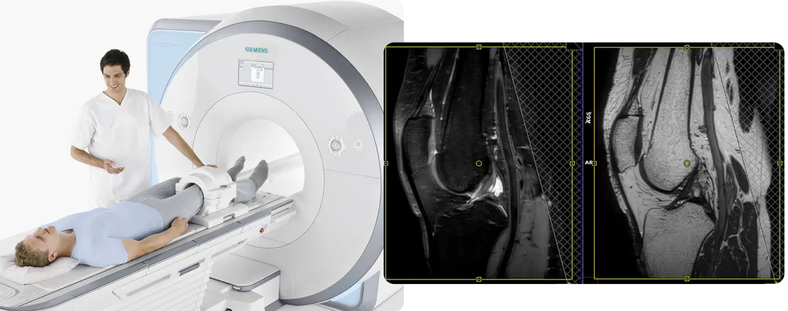 Orthopedic MRI exam