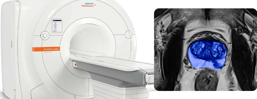 Prostate MRI exam