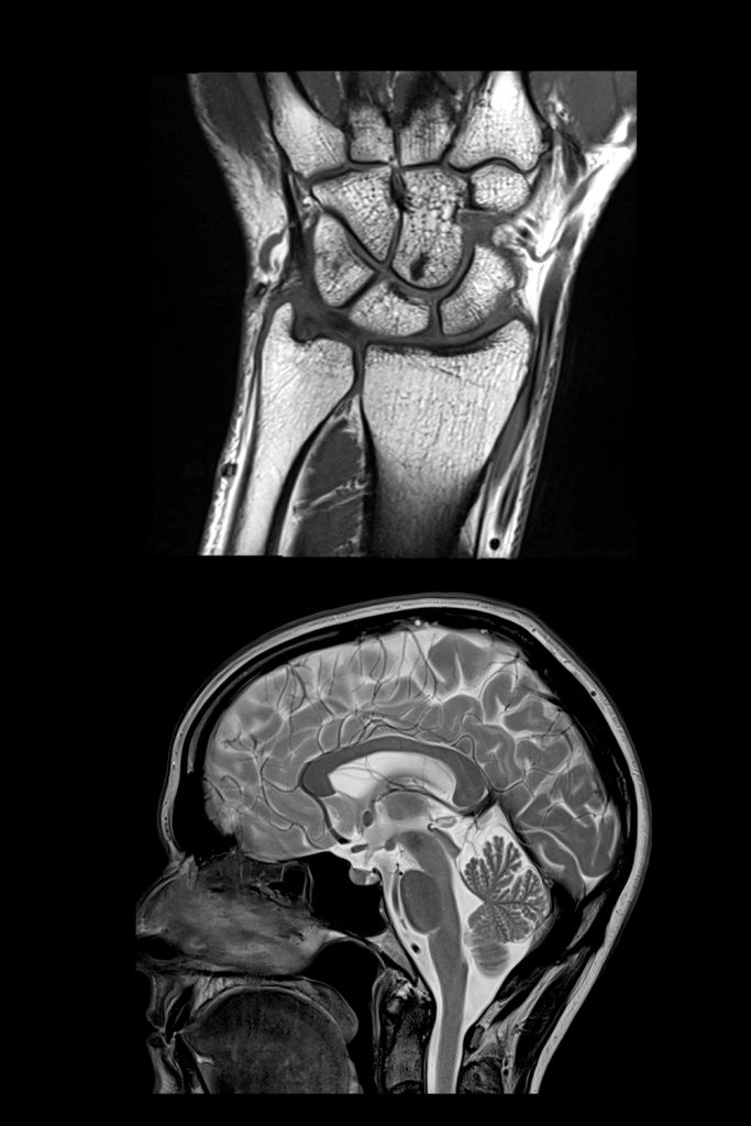 MRI ZwangerPesiri Radiology