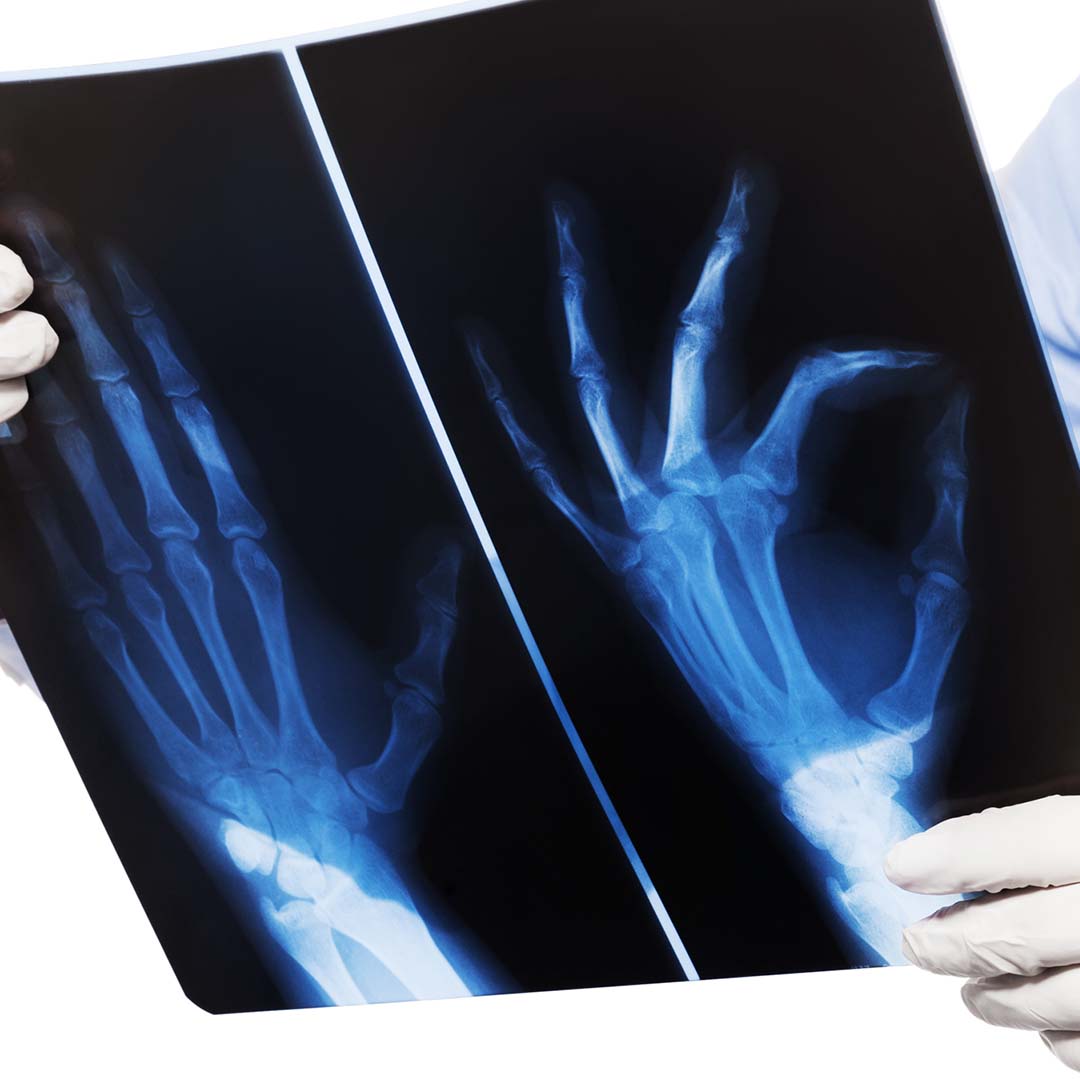 1080x1080Social-3 doctor looking at an x-ray image of a hand