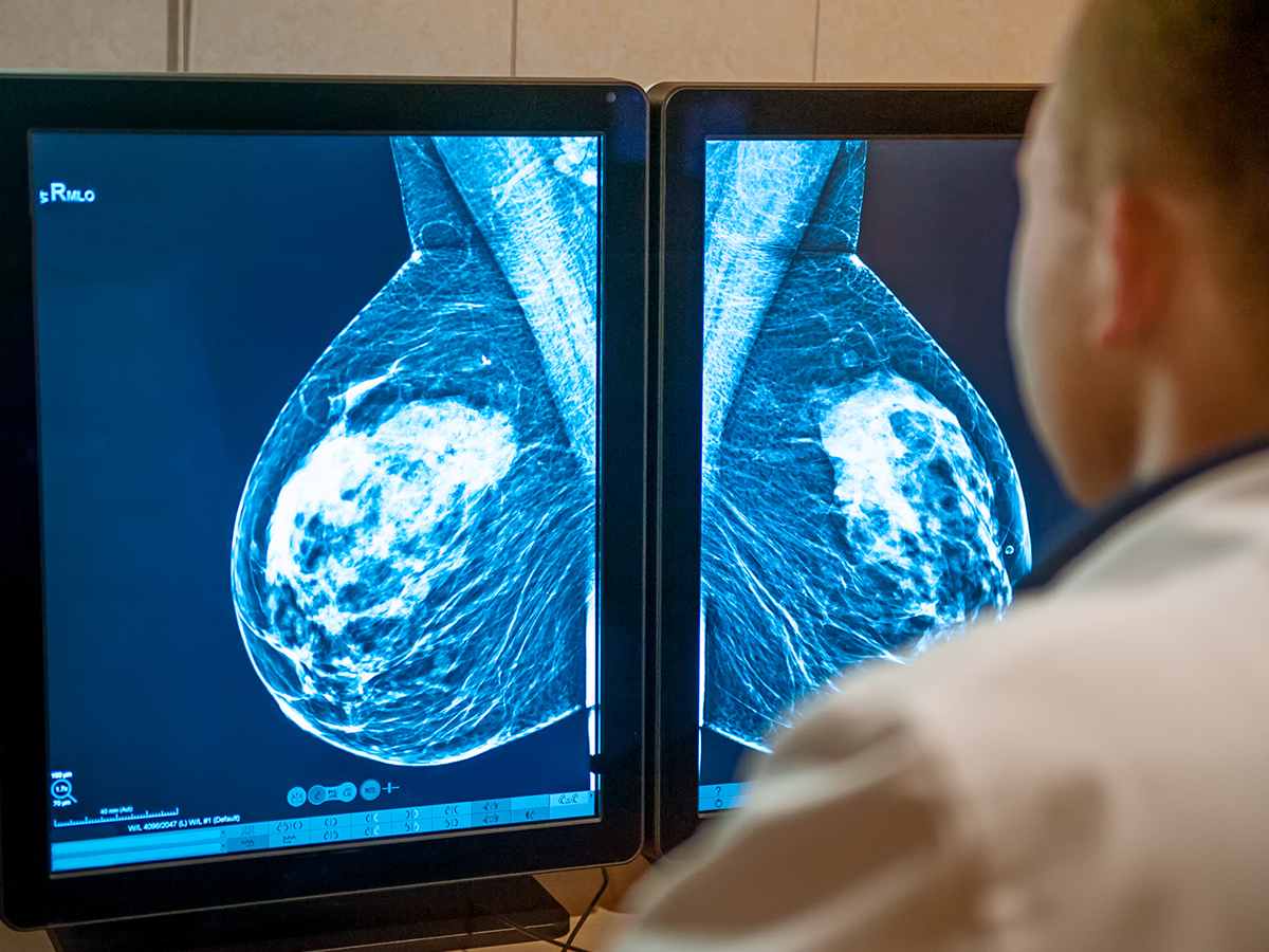 1200x900GMB-1 doctor looking at breast x-rays